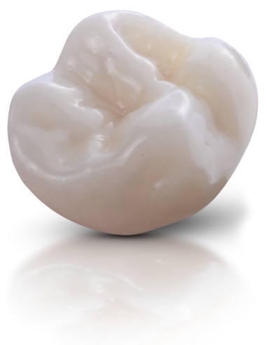 FGM Voxelprint ceramic MT B1 250gr.