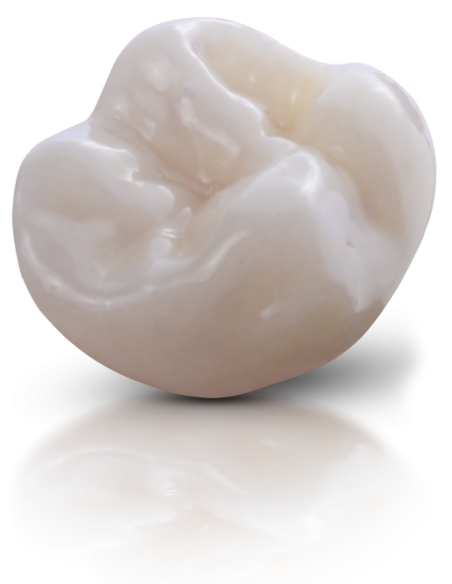 FGM Voxelprint ceramic MT B1 250gr.